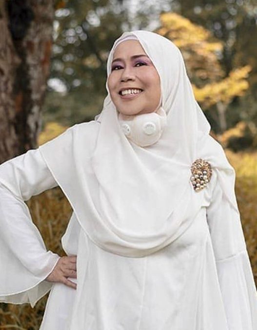 Kisah kehilangan mata kanan