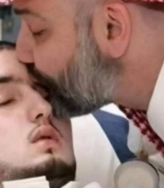 Meninggal dunia setelah 20 tahun koma