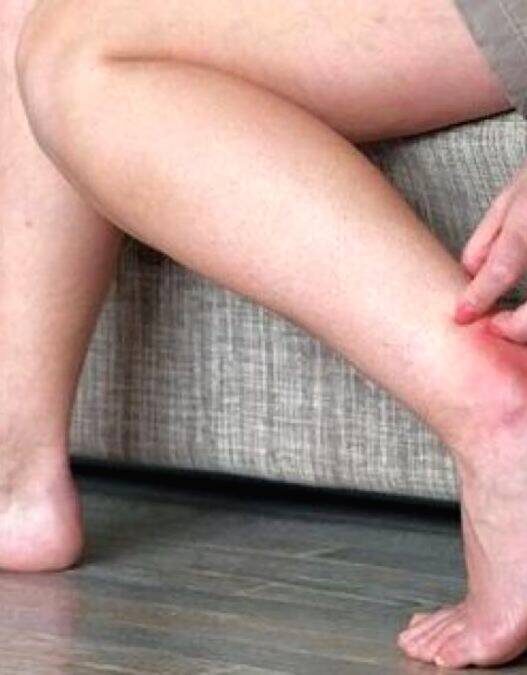 Kolesterol kaki