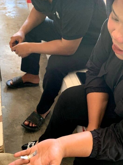 Cincin Tersangkut di Jari, Damkar Turun Tangan