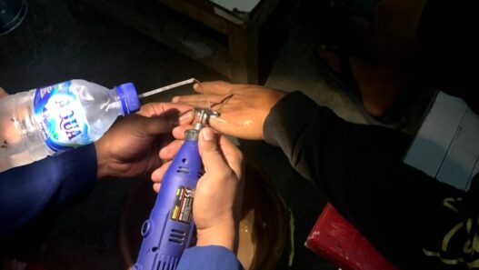 Jari Membengkak, Cincin Tak Bisa Lepas