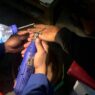 Jari Membengkak, Cincin Tak Bisa Lepas