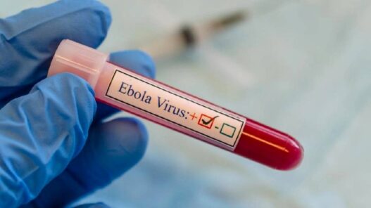 Pelancong Berisiko Ebola Dikarantina 21 Hari