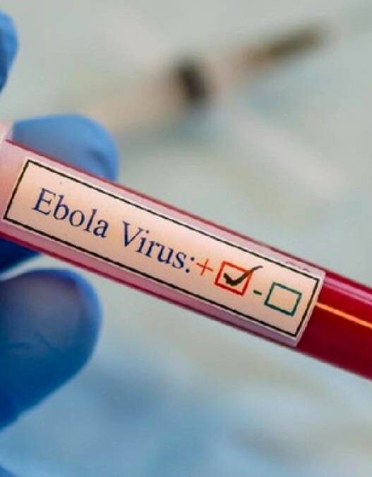 Pelancong Berisiko Ebola Dikarantina 21 Hari
