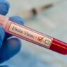 Pelancong Berisiko Ebola Dikarantina 21 Hari