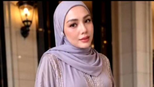 Bakal Permak Gigi dan Facelift
