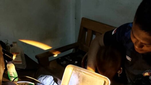 Jari Bocah Tersangkut Jalu Sepeda