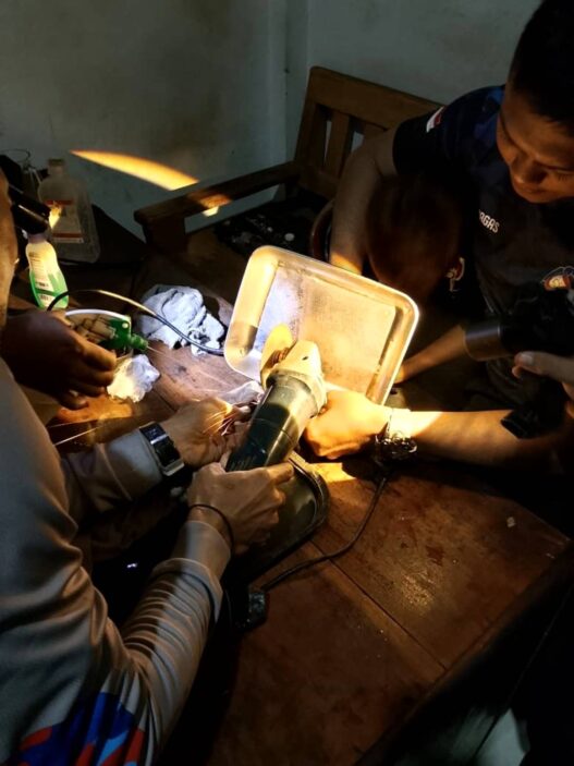 Jari Bocah Tersangkut Jalu Sepeda