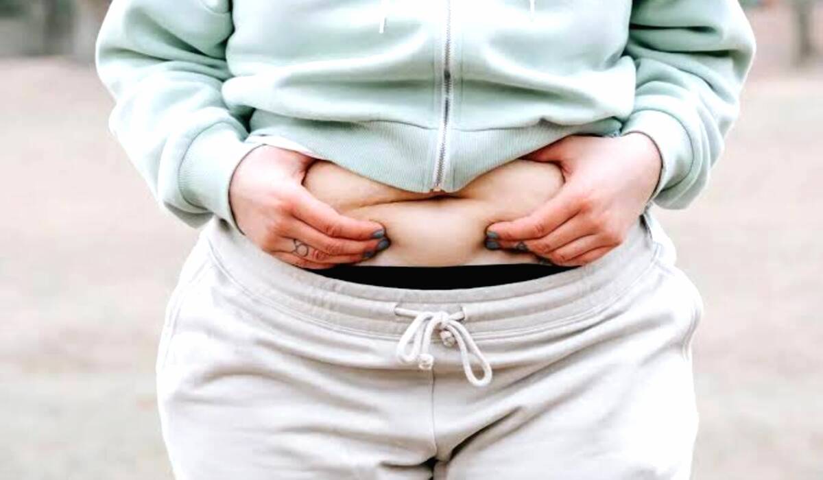 Obesitas Pada Remaja