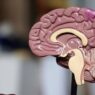 Penelitian Terbaru Pulihkan Otak dari Stroke