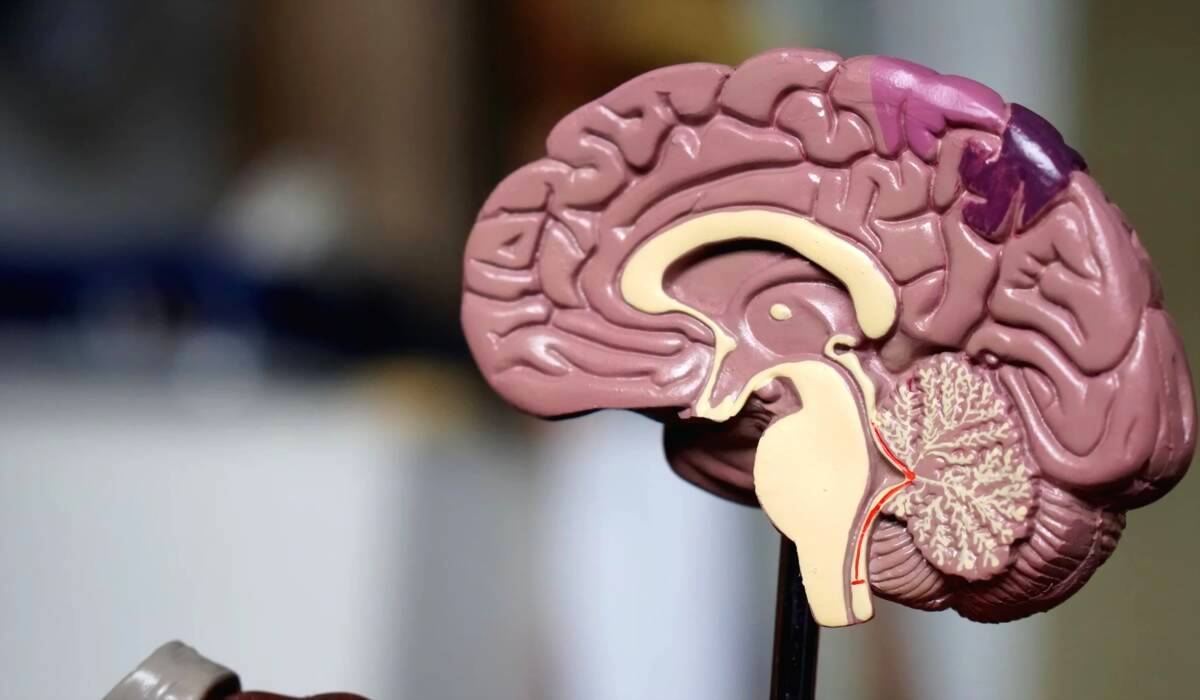 Penelitian Terbaru Pulihkan Otak dari Stroke